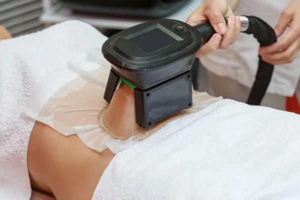 Image of person having fat freezing treatment to help weight gain Royal Leamington Spa