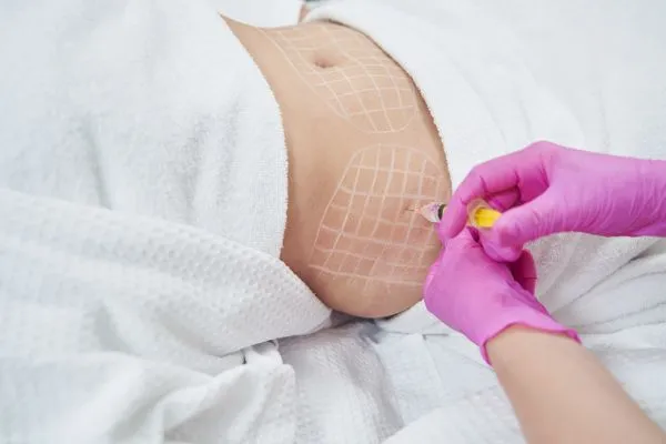 image of fat dissolving injections on love handles to help combat weight gain Royal Leamington Spa