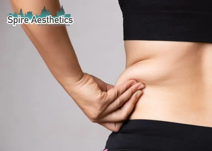 Image of woman pinching fat on their hips Royal Leamington Spa. Fat Freezing treatment 