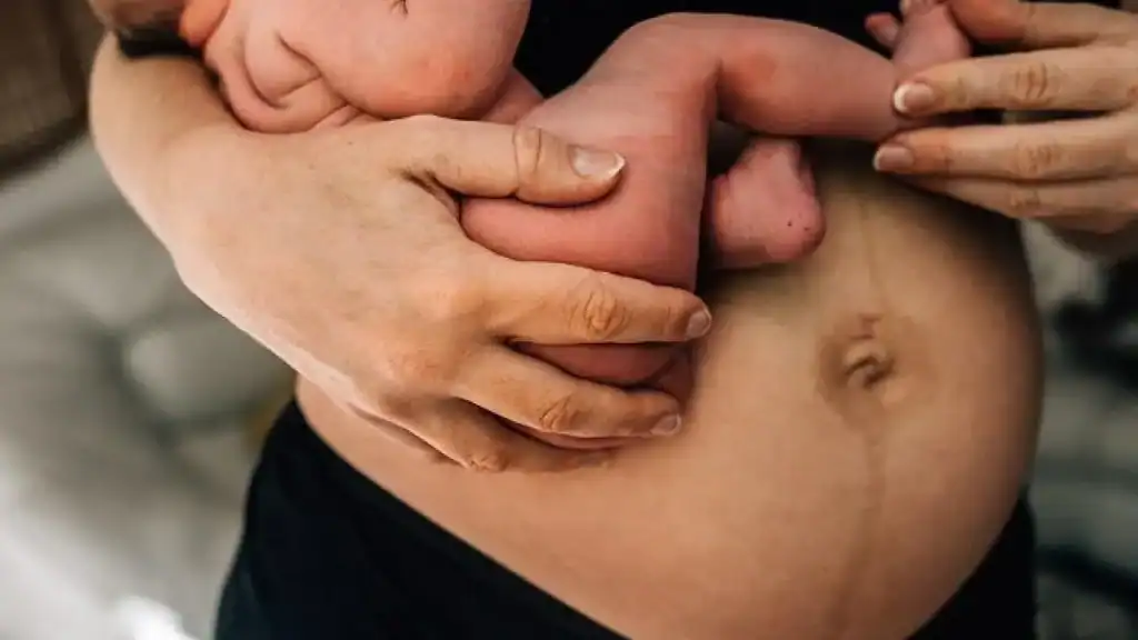 Why Is My Stomach Still Big After Pregnancy Royal Leamington Spa?
